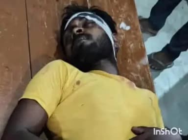 जलालपुर: जलालपुर में सड़क पर आई मानसिक रूप से बीमार महिला को बचाने के प्रयास में तीन लोग घायल, बाइक भी हुई क्षतिग्रस्त