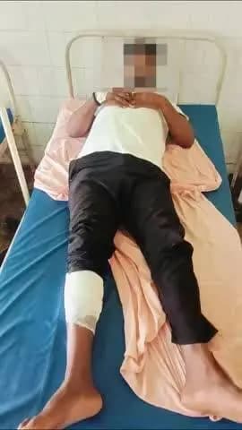 जौनपुर: पुलिस मुठभेड़ में 5 बदमाश गिरफ्तार, एक के पैर में लगी गोली; भारी मात्रा में अवैध असलहे बरामद