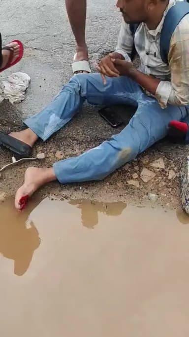 तिजारा के पास बिजली गिरने से 2 लोग घायल हो गए
#तिजारा@