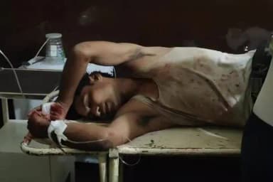 पटियाली: नवादा के पास दो बाइकों की आमने-सामने भिड़ंत, युवक गंभीर घायल, जिला अस्पताल किया गया रेफर