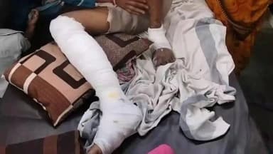 भिंड नगर: परा गाँव के पास बाइक खंती में गिरने से युवक घायल