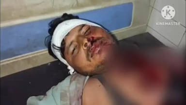 कुरावली: कुरावली क्षेत्र में दबंग चाचा ने भतीजे के साथ की मारपीट, पुलिस ने दर्ज किया मुकदमा