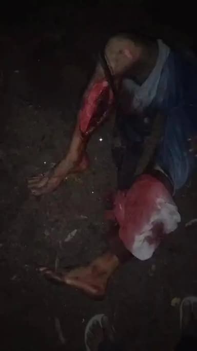 roorkee station par ek ladke ka railway ke sath exident ho kafi halat kharab