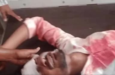 शोहरतगढ़: गणेशपुर के पास सतौवा नाला पुल पर पिकप की ठोकर से एक युवक गंभीर रूप से घायल हुआ
