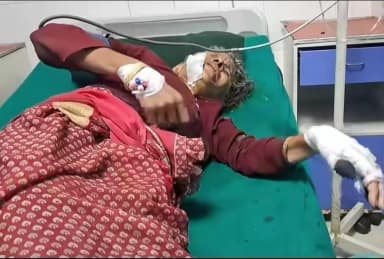 रुद्रप्रयाग: सुमाड़ी में जंगली सूअर का हमला, महिला गंभीर रूप से घायल, जिला अस्पताल में सर्जन नहीं
