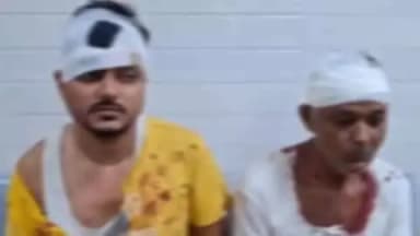 डोमचांच: डोमचांच के जानपुर में जमीन विवाद को लेकर दोनों पक्षों में हिंसक झड़प, कई घायल