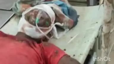 देेेवरिया: देवरिया के मदरापाली गांव में प्रेमिका से मिलने पहुंचे प्रेमी ने नाबालिक भाई पर कुदाल से किया हमला, गंभीर रूप से घायल