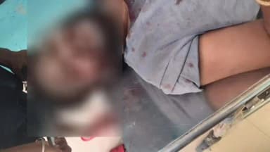 பெரம்பலூர்: பெரம்பலூரில் பொது இடத்தில் மது அருந்தியதை தட்டிக் கேட்டவரை அறிவாளல் வெட்டியவர்களை போலீசார் தேடி வருகின்றனர்