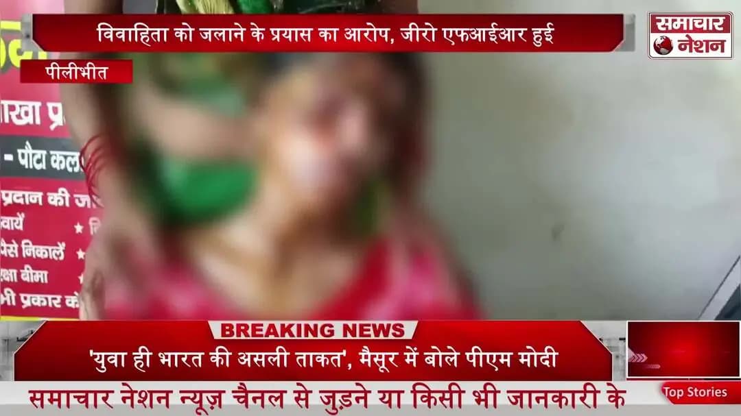 विवाहिता को पेट्रोल डालकर जिंदा जलाने वाले के ससुराल पक्ष वालों के खिलाफ थाना बरखेड़ा में जीरो एफआईआर दर्ज