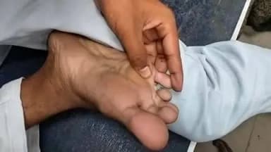 सासनी: घर जाते समय एक युवक के पैर पर जहरीले कीड़े ने काटा, हालत बिगड़ने पर परिजन अस्पताल लाए, डॉक्टरों ने किया उपचार