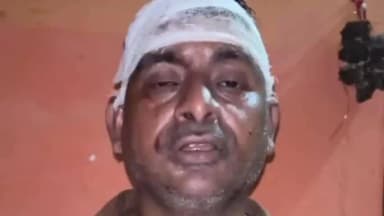 आंवला: आंवला के व्यक्ति ने भमोरा पुलिस से शिकायत की, ससुरालियों पर मारपीट और मोबाइल-नकदी गिरने का लगाया आरोप