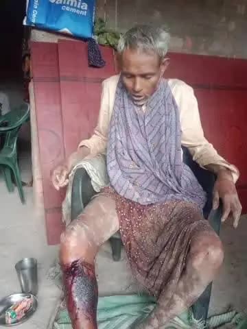 ଖରିଆର: ଖଡୁପାଣି ଗ୍ରାମରେ ଭାଲୁ ଆକ୍ରମଣରେ ବୃଦ୍ଧ ଗୁରୁତର, ନୂଆପଡ଼ା ସ୍ଥାନାନ୍ତର