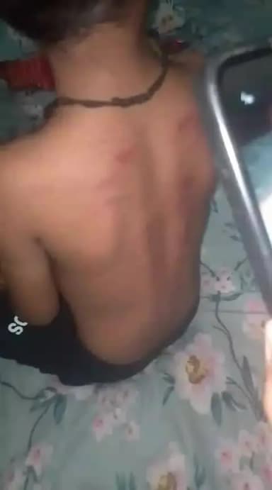 इटावा में 4 साल के बच्चे को बहुत ही बेरहमी से पीटा गया स्कूल में