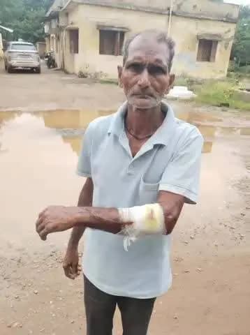 सक्ती: ग्राम कटौद में घुसा जंगली बरहा, हमले में तीन लोग घायल, गांव में दहशत का माहौल