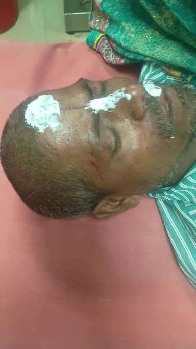 देेेवरिया: सदर कोतवाली क्षेत्र में बाइक टक्कर, मुरली धर गंभीर रूप से घायल