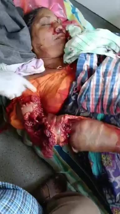బయ్యారం: మహబూబాబాద్ జిల్లాలో ఘోర ప్రమాదం: ఆటోను ఢీకొట్టిన ట్రాక్టర్, మహిళ మృతి