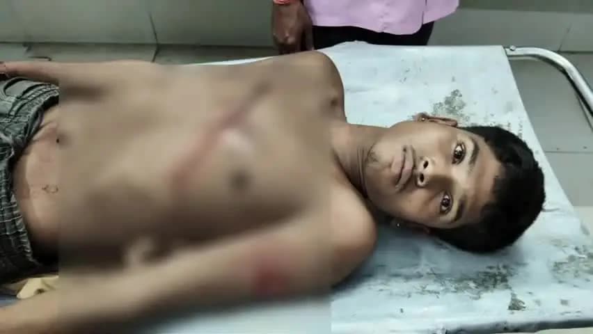 देवरी: केसली से खाद लेकर लौट रहे दो बाइक सवार युवकों पर मुआर-सहजपुर रोड पर कटर से हमला, एक की हालत गंभीर