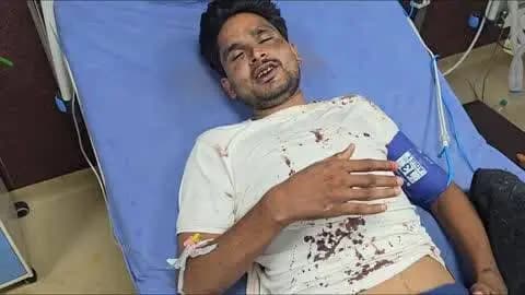 लाडपुरा: बोरखेड़ा थाना क्षेत्र के प्रताप नगर में मोटरसाइकिल दुर्घटना में युवक गंभीर घायल, एमबीएस अस्पताल में भर्ती