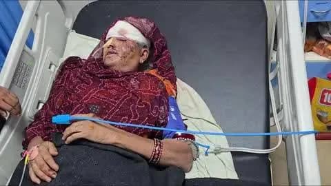 लाडपुरा: बारां झालावाड़ मार्ग पर मोटरसाइकिल पंचर होने के कारण दुर्घटनाग्रस्त महिला गंभीर घायल, एमबीएस अस्पताल में भर्ती