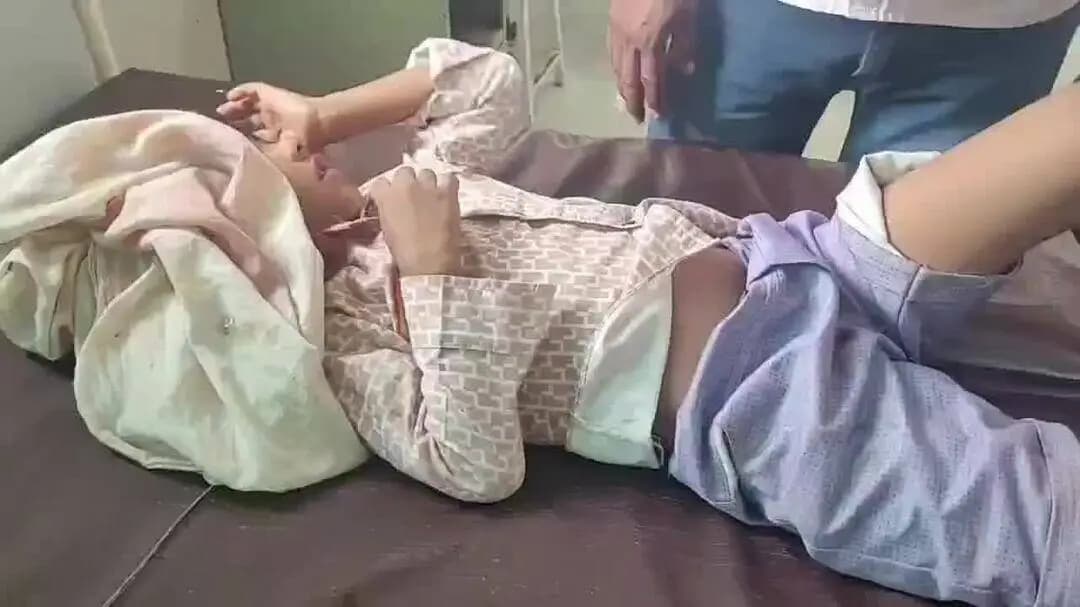 खंडवा नगर: खूंखार कुत्तों का आतंक! बेटे को नोचने लगा कुत्ता, पिता ने छुड़ाया... 6 साल की बच्ची भी बनी शिकार