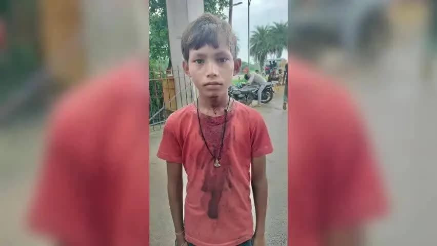 अतरौली: दादों में रास्ते और खेत के बंटवारे को लेकर हुई मारपीट, महिला सहित 2 घायल