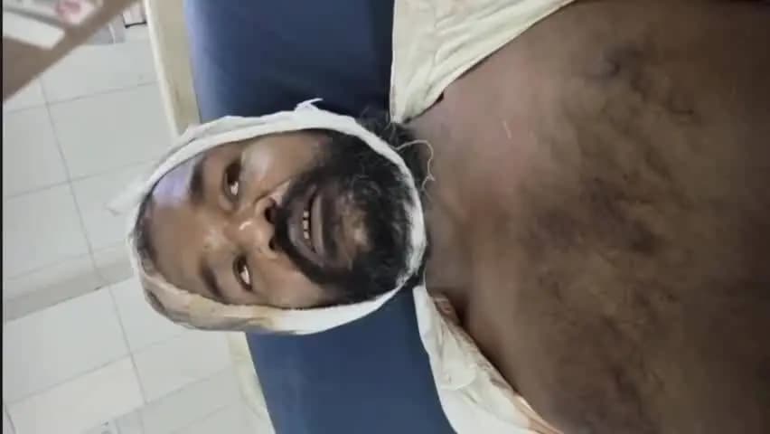 बेल्थरा रोड: भूमि विवाद में नगरा थाना क्षेत्र के नागरिक विकास पार्टी के मंडल अध्यक्ष पर जानलेवा हमले का आरोप, मऊ में चल रहा इलाज
