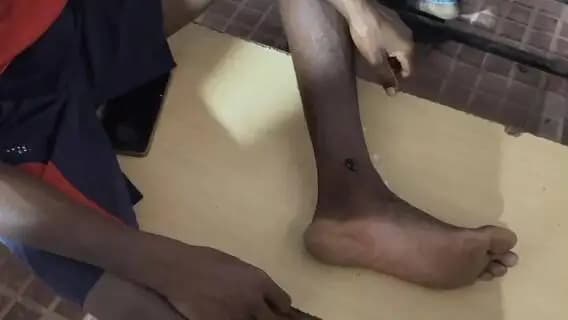 राजपुर: सांप के जहर को चुंबक से निकालने का अंधविश्वास, अस्पताल के अंदर की तस्वीर देखकर रह जाएंगे हैरान