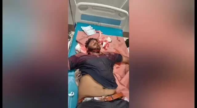 திருவள்ளூர்: திருவள்ளூர் அருகே உறவினரின் இறுதி சடங்கில் ஏற்பட்ட தகராறில் தவெக நிர்வாகிக்கு அறிவால் வெட்டால் பரபரப்பு.