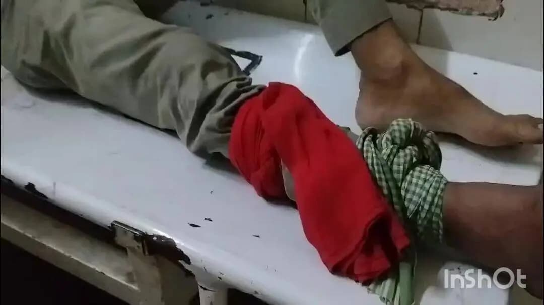 बांदा: नरैनी में घर के बाहर बैठे एक व्यक्ति को जहरीले सांप ने काटा, दोनों को जिला अस्पताल में कराया भर्ती
