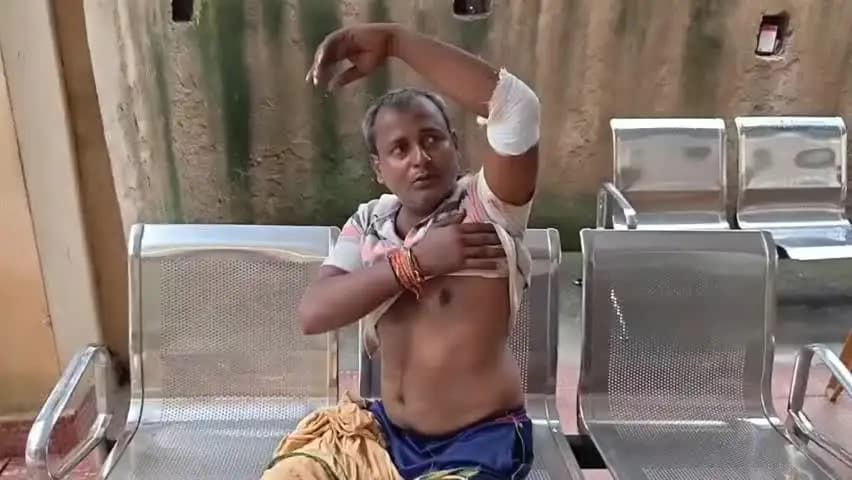तारापुर: सड़क से टोटो हटाने को कहने पर ऑटो चालक पर कैंची से हमला, आरोपी गिरफ्तार