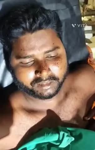 गड़हनी: गड़हनी में दिनदहाड़े एक युवक को अपराधियों ने मारी गोली, युवक का आरा में चल रहा इलाज