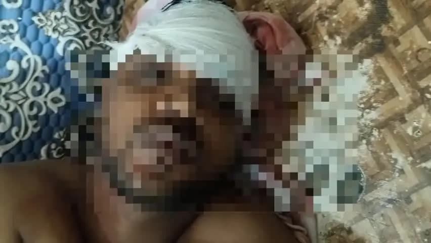 बेल्थरा रोड: बेल्थरारोड नगर के वार्ड 9 में डिलीवरी बाइक से भिड़ी बाइक, युवक की हालत नाजुक