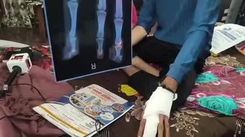 आबू रोड: आबूरोड के मूदरला रोड के नजदीक नकाबपोश बदमाशों ने लूट की नीयत से एक्टिवा सवार पर किया हमला, युवक गंभीर घायल