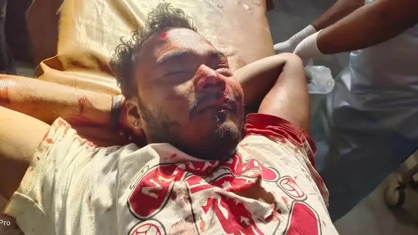 चाईबासा: टोंटो में सड़क हादसा, अज्ञात युवक गंभीर रूप से घायल, सदर अस्पताल में भर्ती, पहचान की अपील