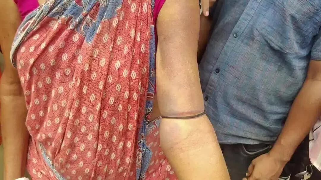 বিশালগড়: বিশ্রামগঞ্জ নলজলা এলাকায় শহীদ মিঞা নামক এক যুবক কর্তৃক ৭০ বছরের লক্ষ্মী সরকারের উপর নির্মম অত্যাচারে