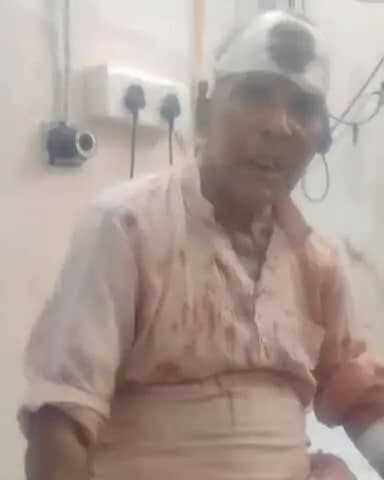 जोगापट्टी: योगापट्टी में पारिवारिक विवाद: बहू ने ससुर को दांत से काटा, डंडे से किया घायल