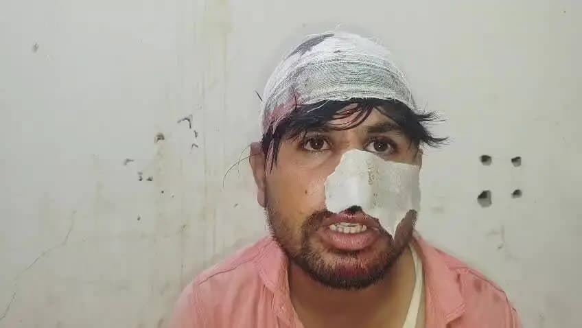 मखदुमपुर: नेवारी निवासी नगर परिषद पर्यवेक्षक अमित कुमार ने जानलेवा हमले के बाद पूरी घटना बताई