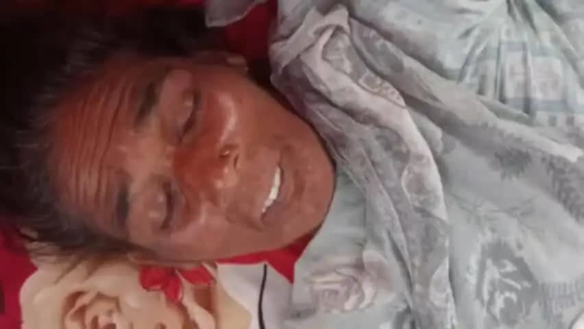 बिलारी: गन्ना पत्ती छील रही महिला पर तेंदुए का हमला, शोर मचाने पर भागा तेंदुआ, महिला बेहोश