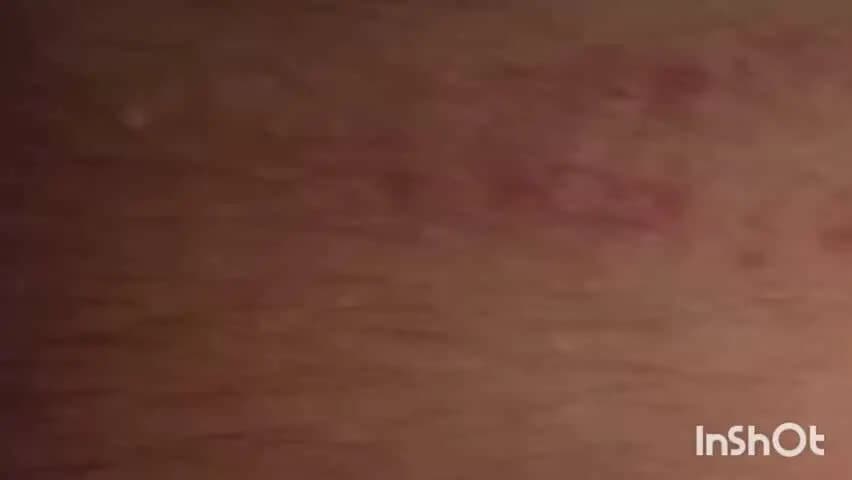 रेवाड़ी: रेवाड़ी: होमवर्क न करने पर शिक्षिका ने छात्र को बुरी तरह पीटा, हाथ-पैरों पर पड़े 10 नीले निशान