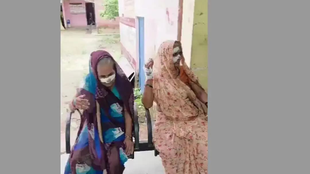 बीकापुर: असकरनपुर ग्राम पंचायत में सियार ने पांच लोगों को काटा, दो महिलाओं की हालत गंभीर