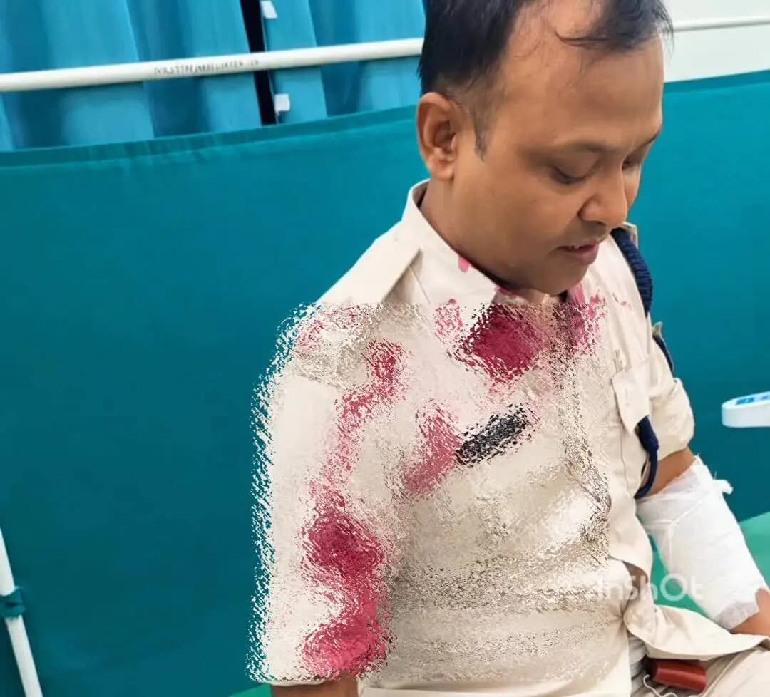 टंडवा: टंडवा में बचाव अभियान के दौरान उग्र भीड़ ने पुलिस पर हमला किया, थानेदार गंभीर घायल, 4 राउंड हवाई फायरिंग