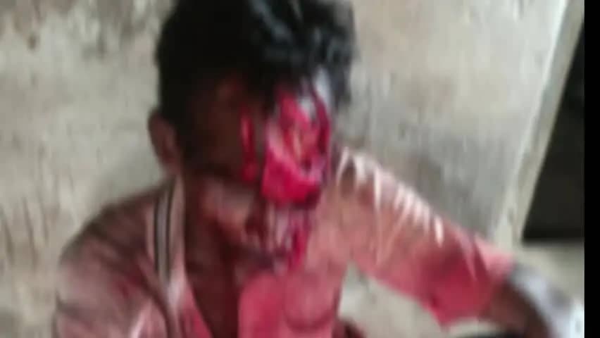 कसडोल: देवपुर बीट में भालू का आतंक, हमले में दो ग्रामीण गंभीर रूप से घायल हुए