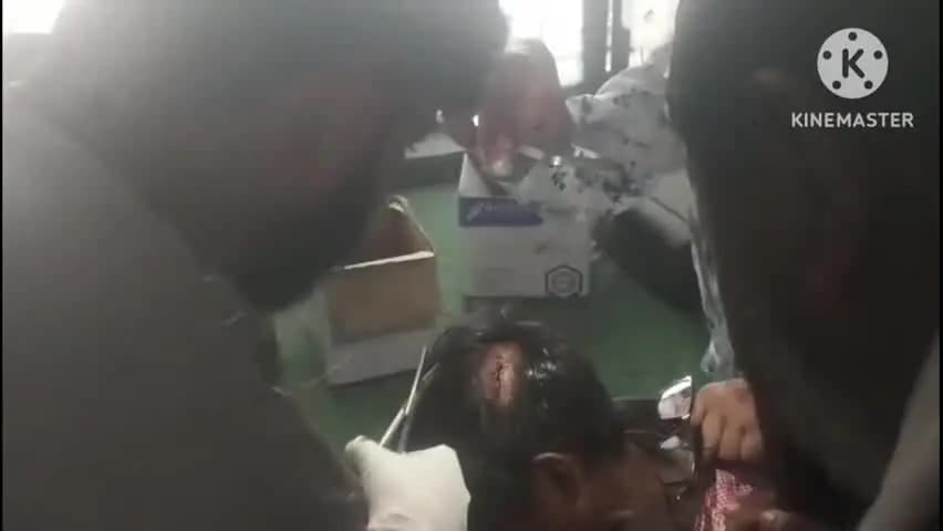 गुन्नौर: कस्बा गुन्नौर के कंपोजिट विद्यालय में पढ़ाई के दौरान छात्र के ऊपर छत पर लगा पंखा गिरा, छात्र हुआ घायल