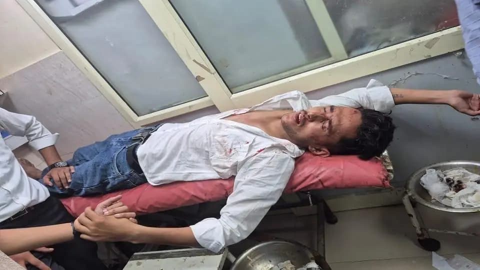 बागेश्वर: बागेश्वर छात्रसंघ चुनाव में हिंसक झड़प, एनएसयूआई नेता गंभीर रूप से घायल