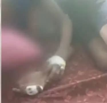 തിരുവനന്തപുരം: തിരുവനന്തപുരത്ത് തെരുവുനായ ആക്രമണം: 11കാരന്റെ കൈവിരൽ നഷ്ടമായി