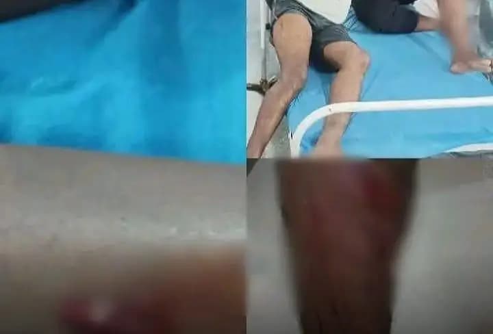 భీమారం: భీమారం బస్టాండ్ వద్ద పిచ్చికుక్క స్వైరవిహారం: నలుగురికి గాయాలు