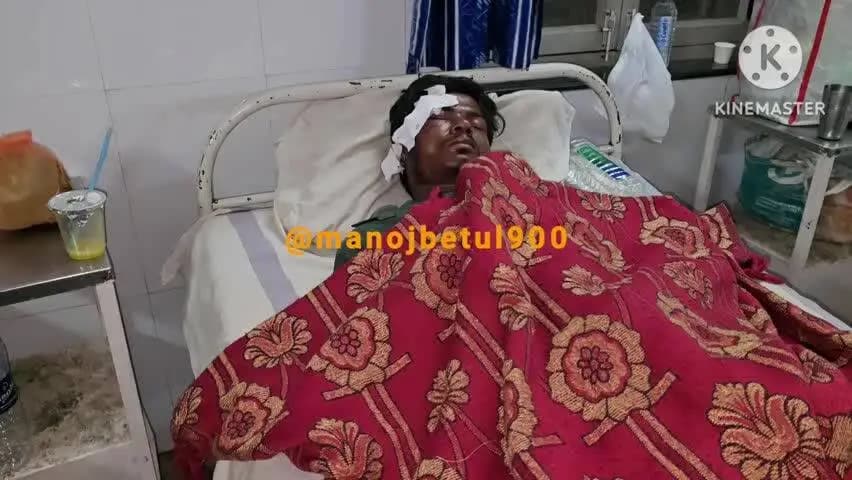 चिचोली: ठेमागांव में अज्ञात वन्य प्राणी से बाइक सवार दो व्यक्ति टकराए, गंभीर घायल, अस्पताल में भर्ती