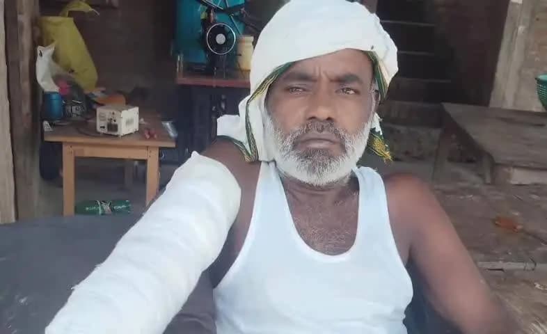 तिर्वा: सिमरिया में झोलाछाप के इलाज पर उठे सवाल, इंजेक्शन के बाद युवक के हाथ में हुई सड़न
