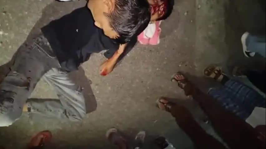टांडा: टांडा लालपुर जौहर यूनिवर्सिटी के रास्ते पर दर्दनाक सड़क हादसा, पिता-पुत्र घायल, मौके पर लोगों की भारी भीड़