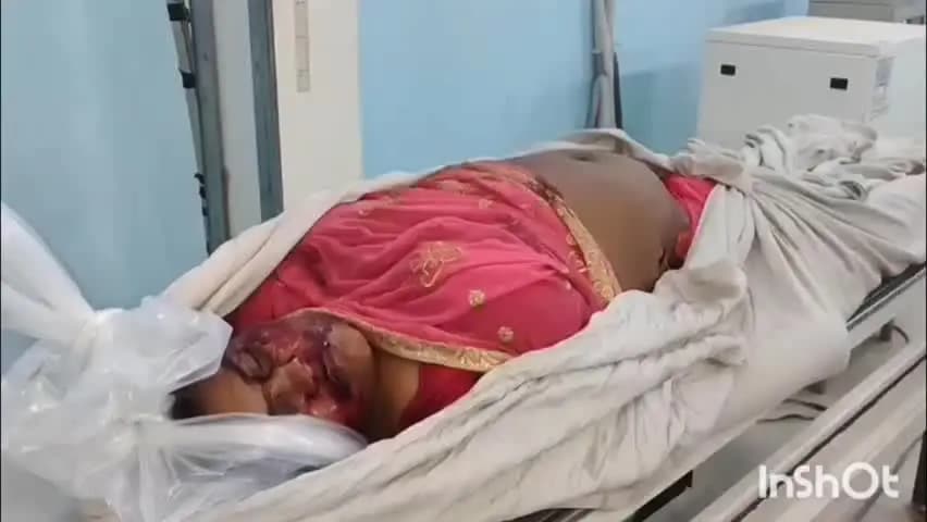 अगिआंव: अगिआंव में महिला की पेट में दो गोली मारकर हत्या, भैंसुर पर लगा आरोप, महिला दिल्ली से दो बेटियों के साथ गांव लौटी थी